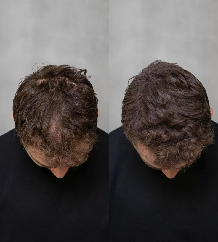 Fibras capilares |Tacks HairFibers™