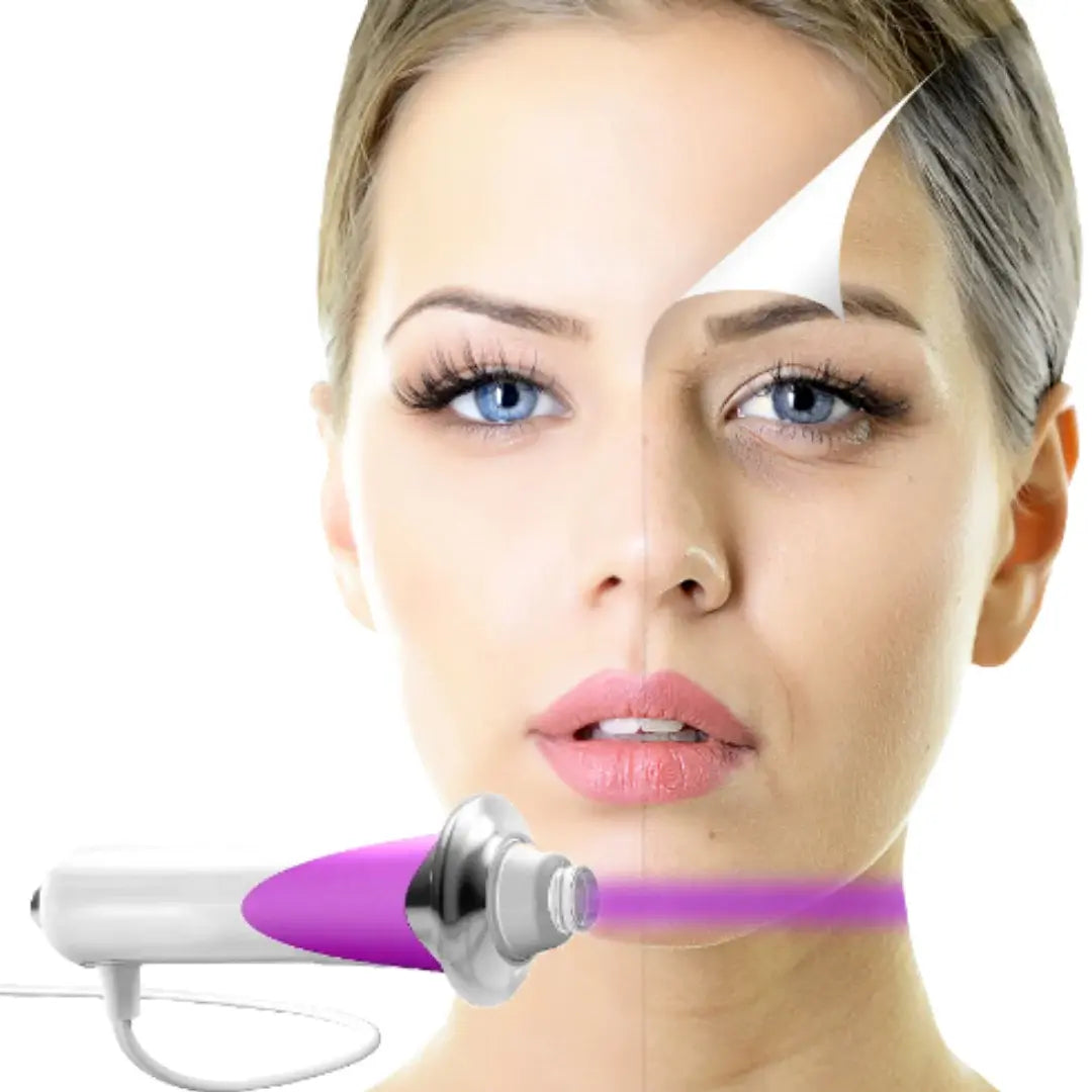 Masajeador Radiofrecuencia Facial | Beauty stick PRO