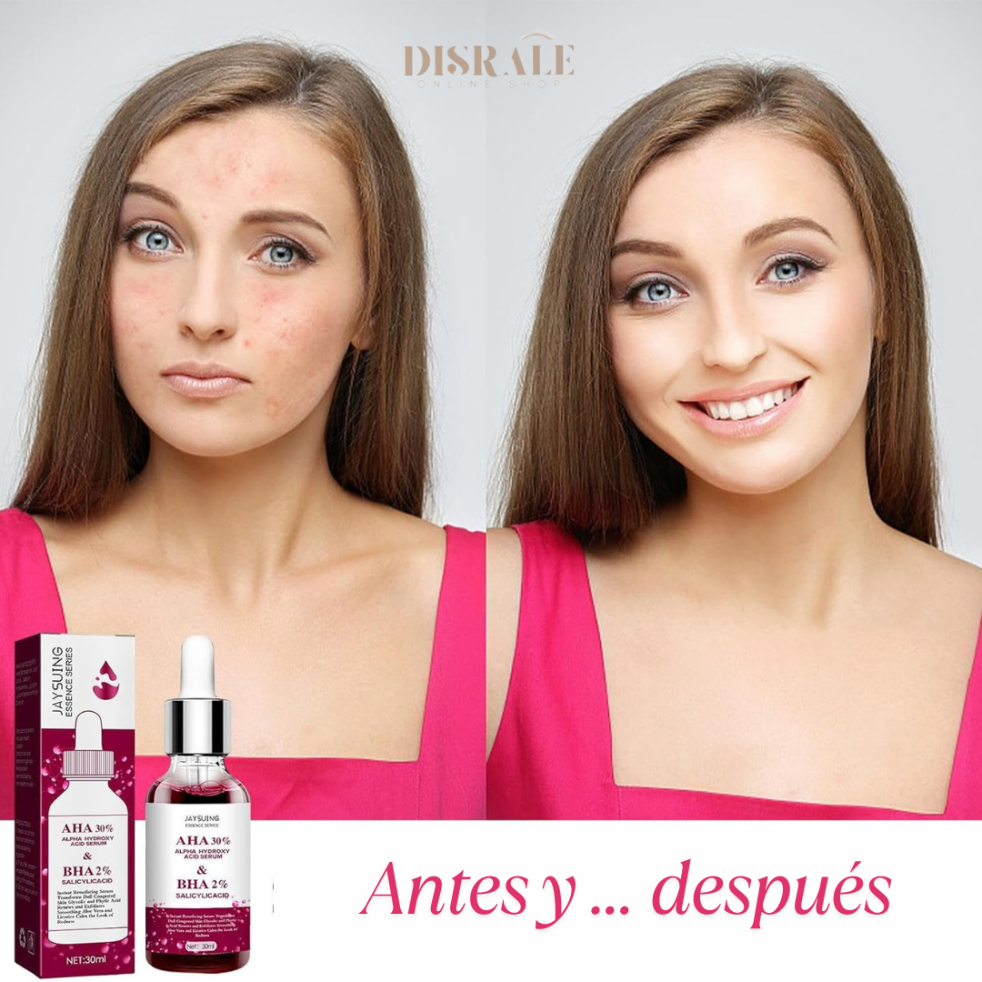 Sérum Facial Calmante Anti-Rojeces GlowRelief™