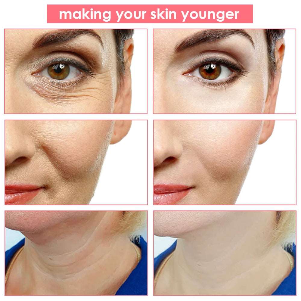 Realive 7 © | Masajeador Facial de Radiofrecuencia | Rejuvenecedor De La Piel