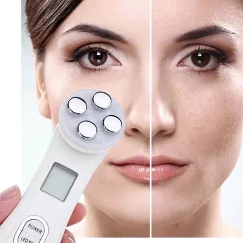 Realive 7 © | Masajeador Facial de Radiofrecuencia | Rejuvenecedor De La Piel