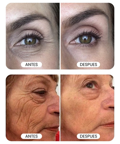 Serum Natural Antiarrugas |  Botox Stock Solution