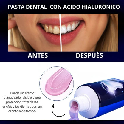 Dúo Smile Perfect™ | Irrigador Dental + Pasta Reparadora con Ácido Hialurónico & Vitamina E