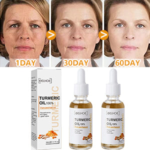 Serum Facial de aceite esencial de Cúrcuma 100%| Pack de 2 x 30 ml