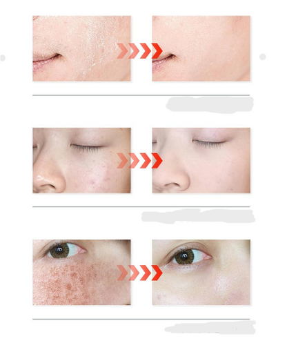 Pads Faciales Calmantes 5% Centella Asiática – Anti-Manchas y Ojeras | KORMESIC (50 und.)